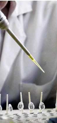 Bij de aids-commissie in België zijn 1.826 buitenlanders als aids-patiënt geregistreerd, 69 procent komt uit zwart-Afrika. Belga<br>