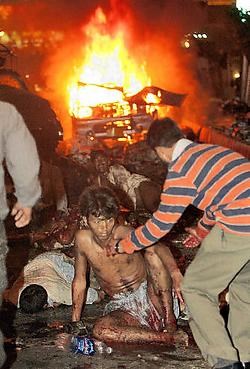 Een dubbele aanslag in Karachi donderdagnacht doodde 133 aanhangers van Bhutto. Deze Pakistani overleefde de moordende explosies.afp<br>