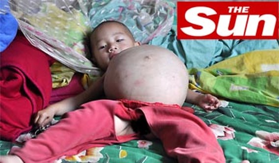 Eenjarige draagt baby in buik