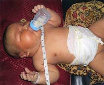 Pasgeboren baby weegt bijna 9 kilo | De Mobile