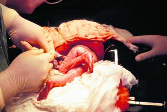 Een zeven maanden oude Franse foetus wordt uit de baarmoeder gelicht voor een operatie aan zijn middenrif. Science Photo Library
