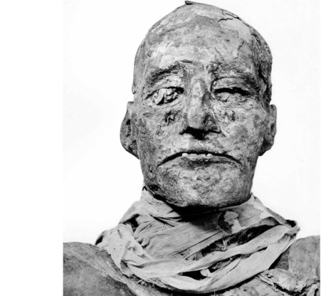Ramses III, slachtoffer van zijn harem. 