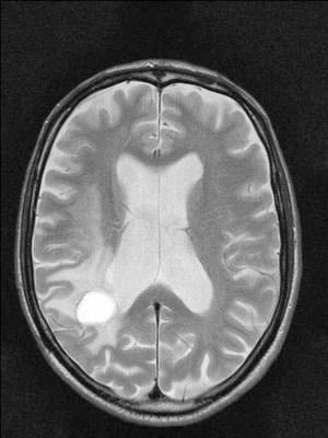 De (geleende) scans met tumor van onze redacteur.