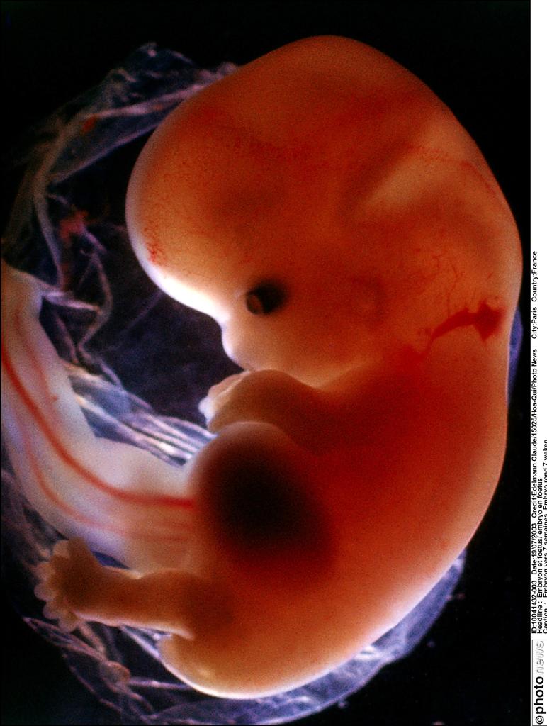 12 недель и 6 дней. Плод на 12 неделе беременности. Эмбрион на 12 неделе беременности. Эмбрион на 11-12 неделе беременности.