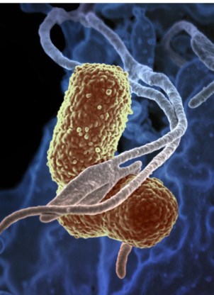 Experts baart één bepaald type bacterie, de CPE-kiemen, het meeste zorgen. Die zijn in Europa aan een felle opmars bezig. (Foto: de bacterie Klepsiella pneumoniae)