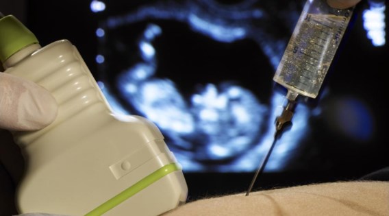 Eén op de tien breekt zwangerschap af bij aangeboren afwijking