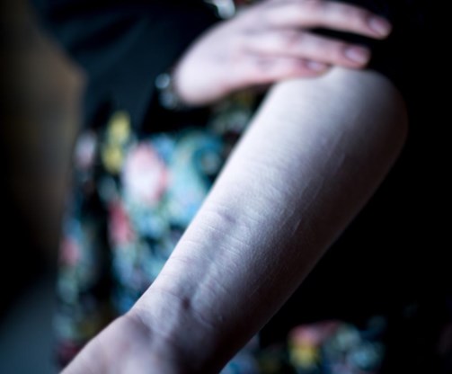 ‘Ik moest iets doen met de pijn die ik vanbinnen voelde’, zegt Francesca Dhoore. ‘Ik zette ze om in fysieke pijn.’