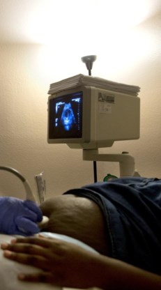 Ook nu bestaat nog ‘abortustoerisme’ naar Nederland.