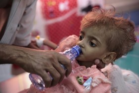 85.000 kinderen gestorven door honger in Jemen