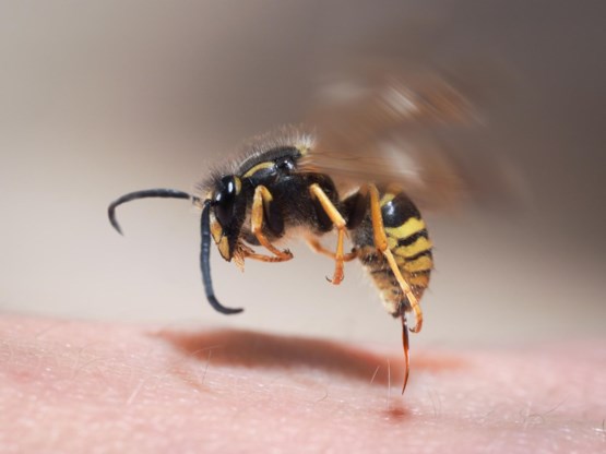 ZOMERCHECK. 'Met een bij- of wespensteek moet je altijd naar de spoed'