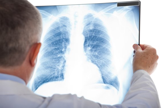 Nieuwe longen redden kritieke covidpatiënt