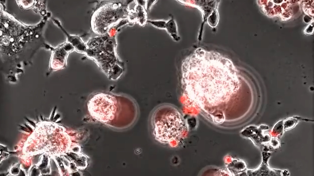 Video shows how destructive the coronavirus behaves in…