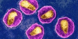 Agressieve hiv-variant ontdekt  in Nederland en België  
