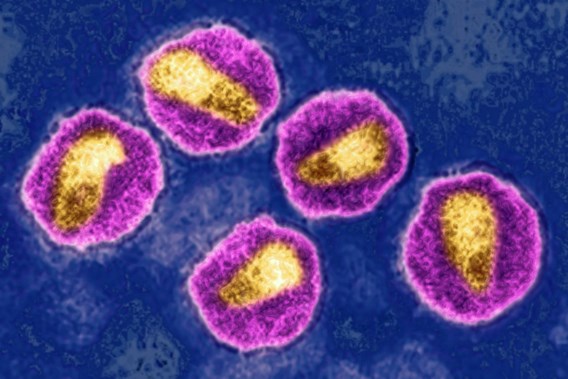 Agressieve hiv-variant ontdekt in Nederland en België
