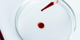 Plastic voor het eerst gemeten in menselijk bloed
