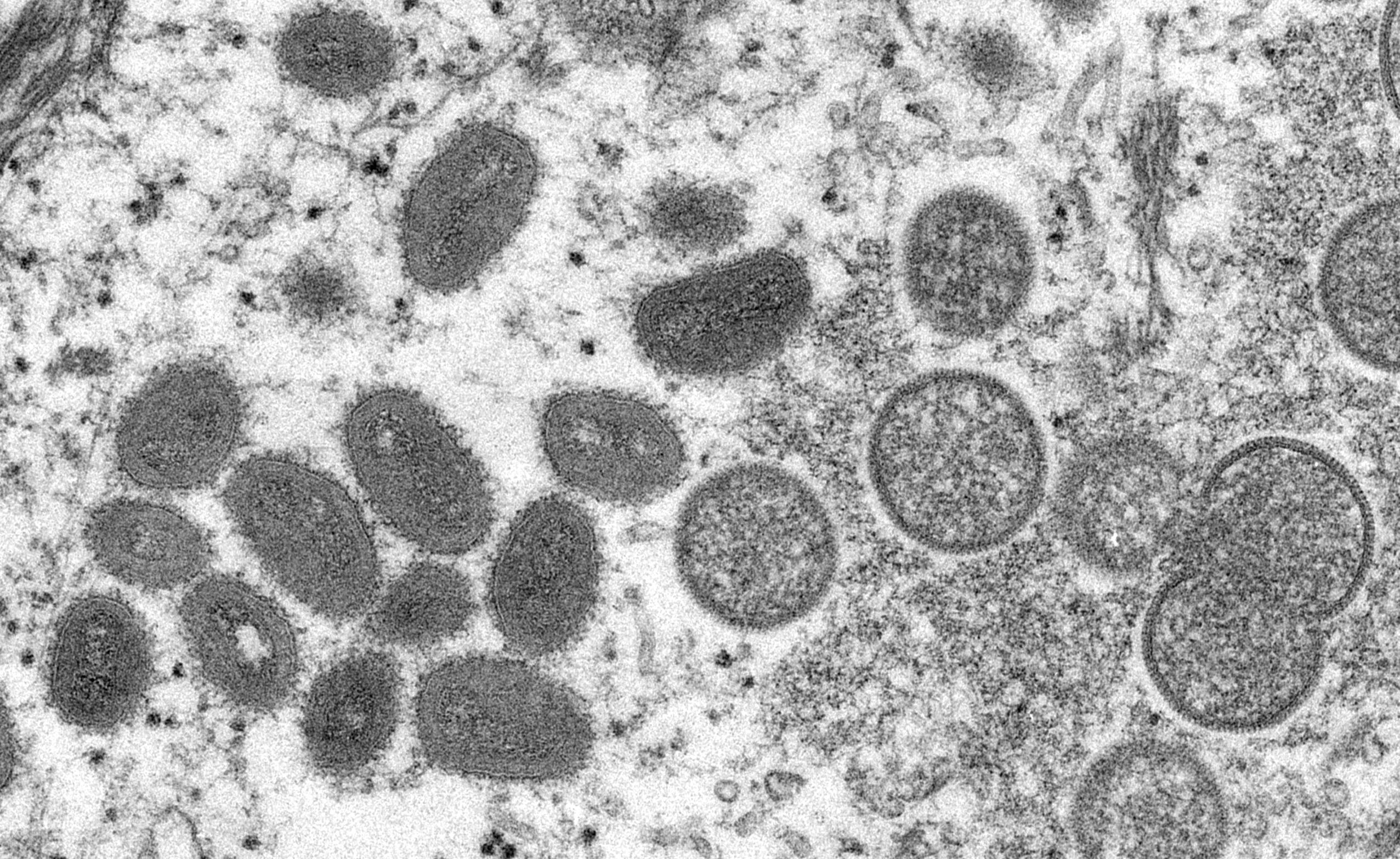 First case of monkey pox turned up in Belgium, what do we know about the virus?