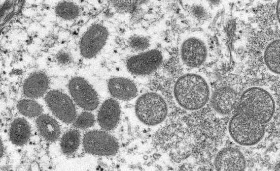Eerste geval van apenpokken opgedoken in België, wat weten we over het virus?