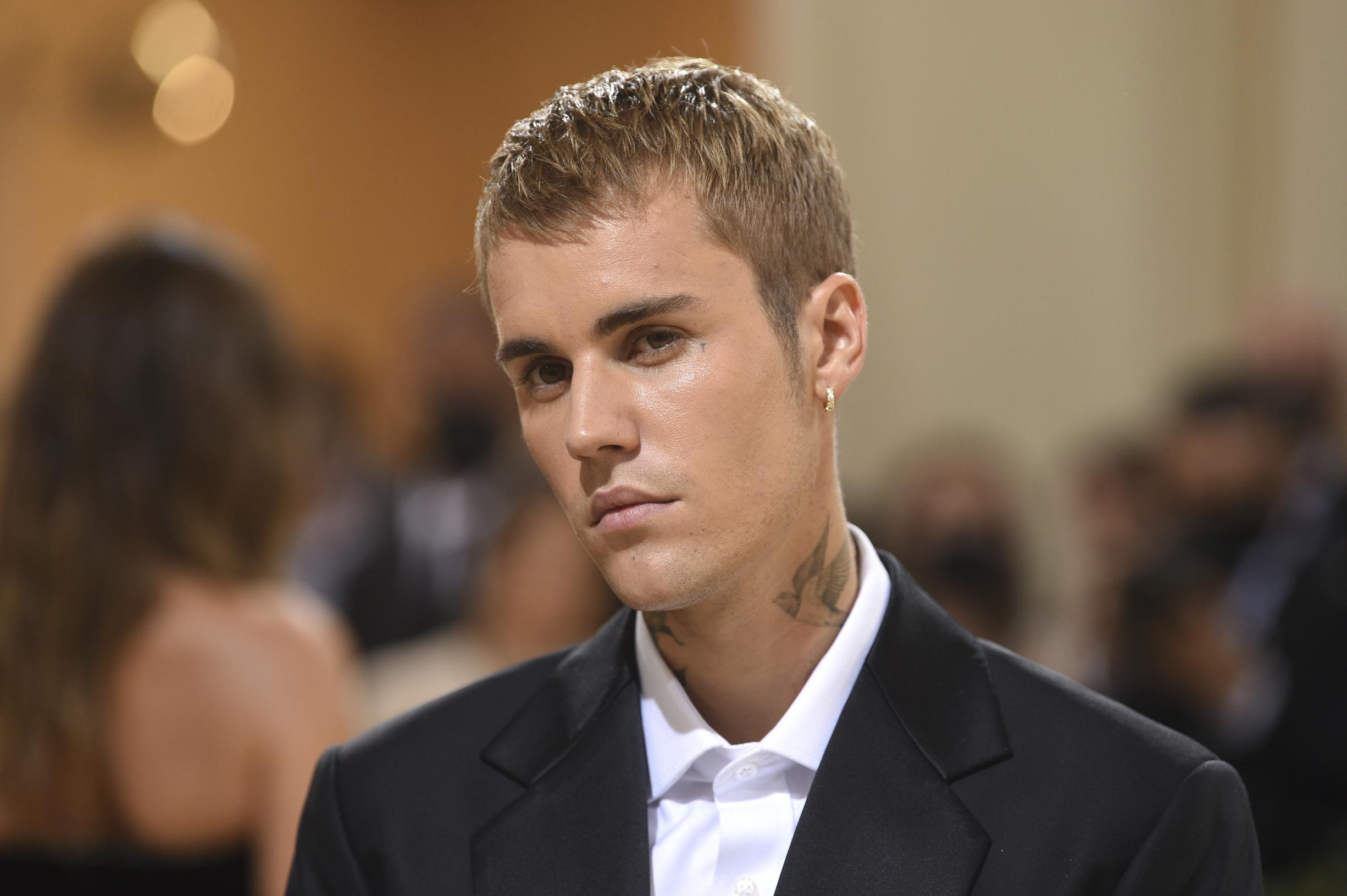 Justin Bieber is half paralyzed in the face from Ramsay-Hunt syndrome