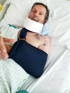 Roger De Vlaeminck breekt drie ribben na aanrijding op fietstocht: ‘Serieuze klap’