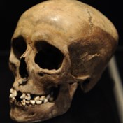 Een schedel uit de oudheid met een bijzonder gaaf gebit, hoe kan dat?