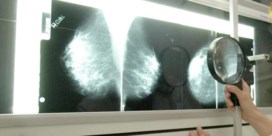 Screening borstkanker wordt wellicht niet uitgebreid