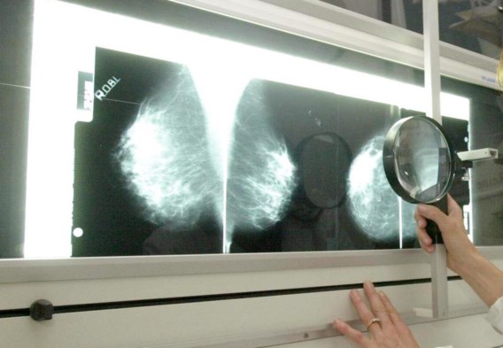 Screening borstkanker wordt wellicht niet uitgebreid