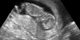 Zal abortus de regering-De Croo dan toch uit elkaar spelen?