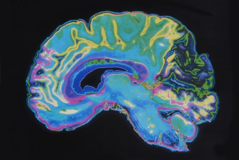 AI-blog | AI kan leiden tot uitsterven mensheid, zeggen onderzoekers en ceo’s