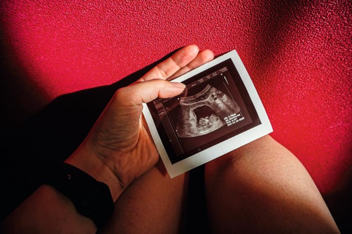 Eerste inloophuis voor zwangerschapsverlies in Vlaanderen: ‘Niet fair als je er dan alleen voor staat’