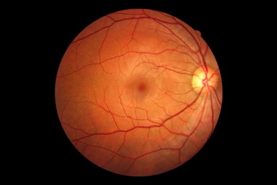 Gene experiment offers hope for treatment of hereditary blindness